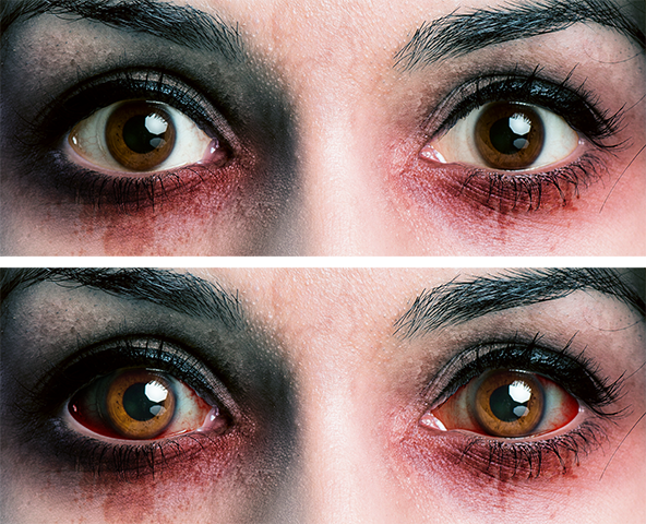 Bloodshot Eyes Photoshop Video Tutorial - Before and After